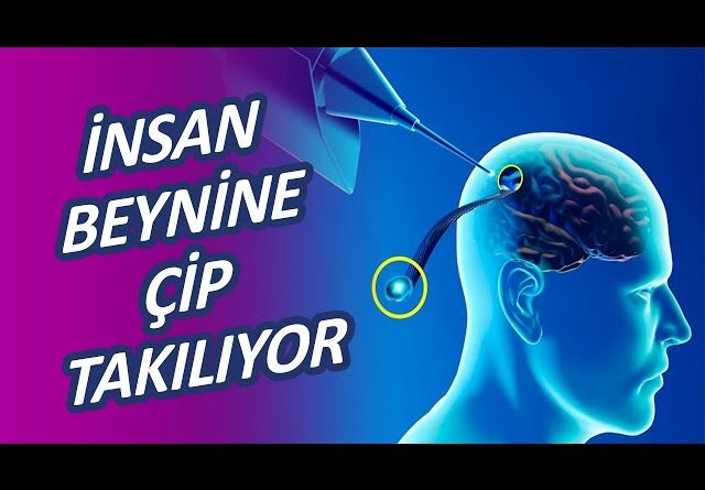 insan beynine çip takmak