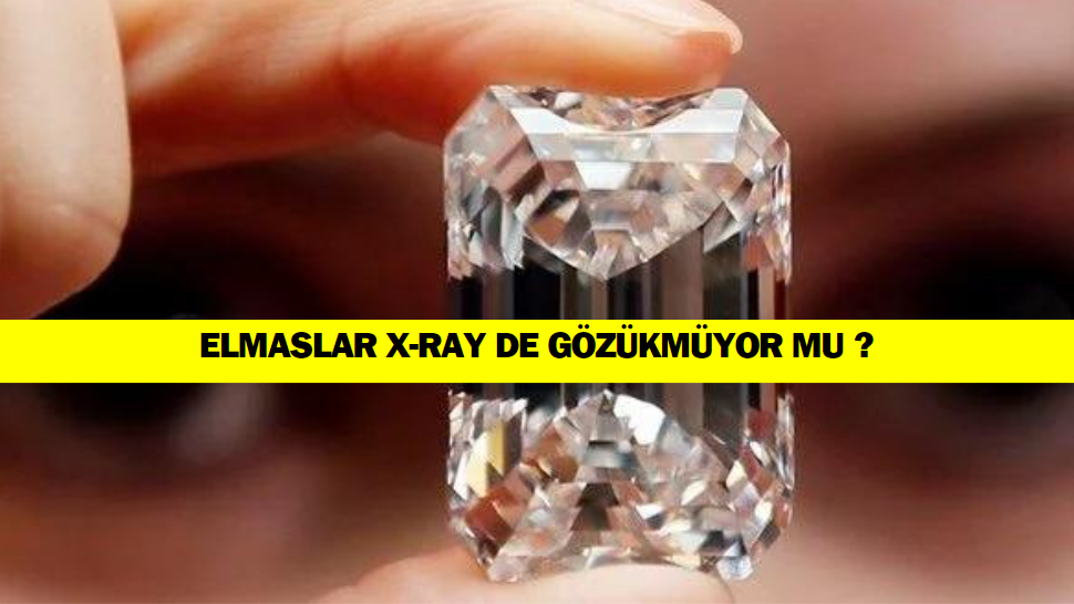 Elmaslar X-Ray Cihazlarında Görünmüyor Mu ?